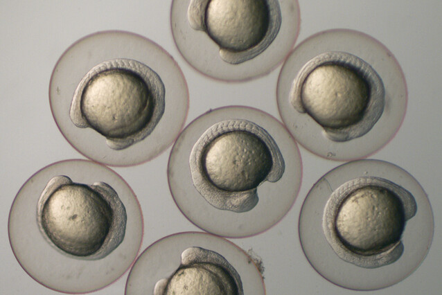 Seven zebrafish embryos float on a grey background. They look like frog eggs, but the yolk is surrounded by a curved, transluscent embryo.