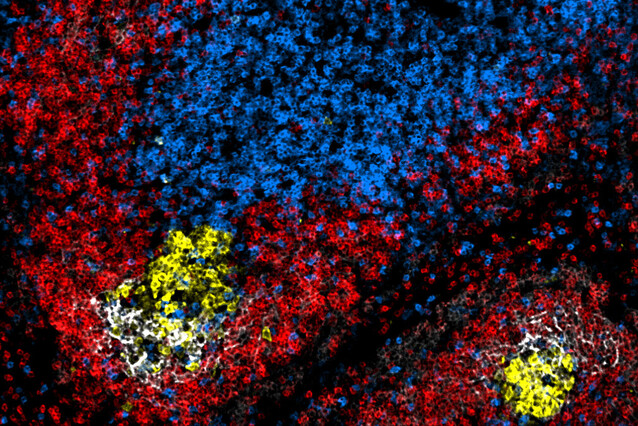 The image is dotted with red-coloured cells, with two yellow and white spots. The centre-top area is blue, also dotted.