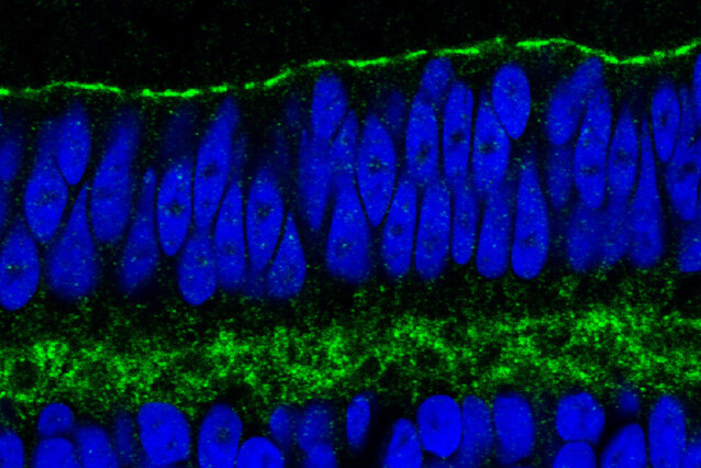 Colourful horizontal cellular layers are stacked. Cell nuclei appear elongated in blue, and are split into two layers by another layer of green dots.