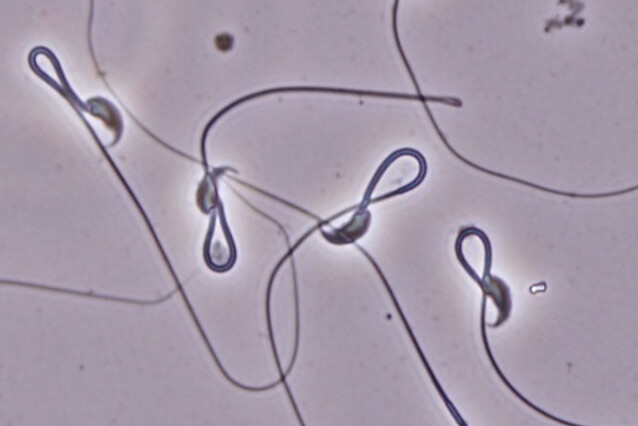 Bluish sperm cells with a pointy hat and long filamentous tail.