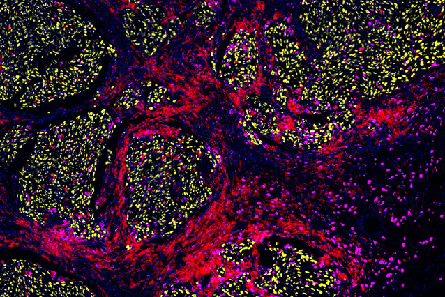 Clumps of yellow dots are surrounded with red and magenta stains of colour.