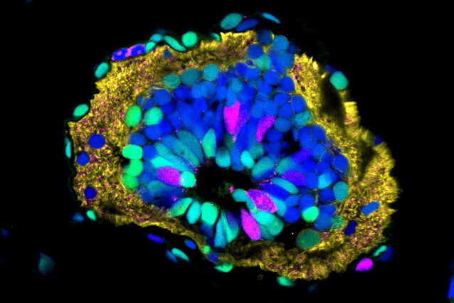 A donut-shaped cross-section of axolotl spinal cord with different cells shown in different colours. Neural stem cells are red and green in the middle, lining the hollow, fluid-filled centre of the spinal cord (central canal). Neurons are located on the outside – nerve fibres are labelled in yellow. Blue labels all cell nuclei.